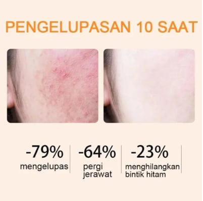 “BBOJI™ Orange Enzyme Exfoliating Gel — The Gentle Miracle Your Skin Has Been Crying Out For”🔥