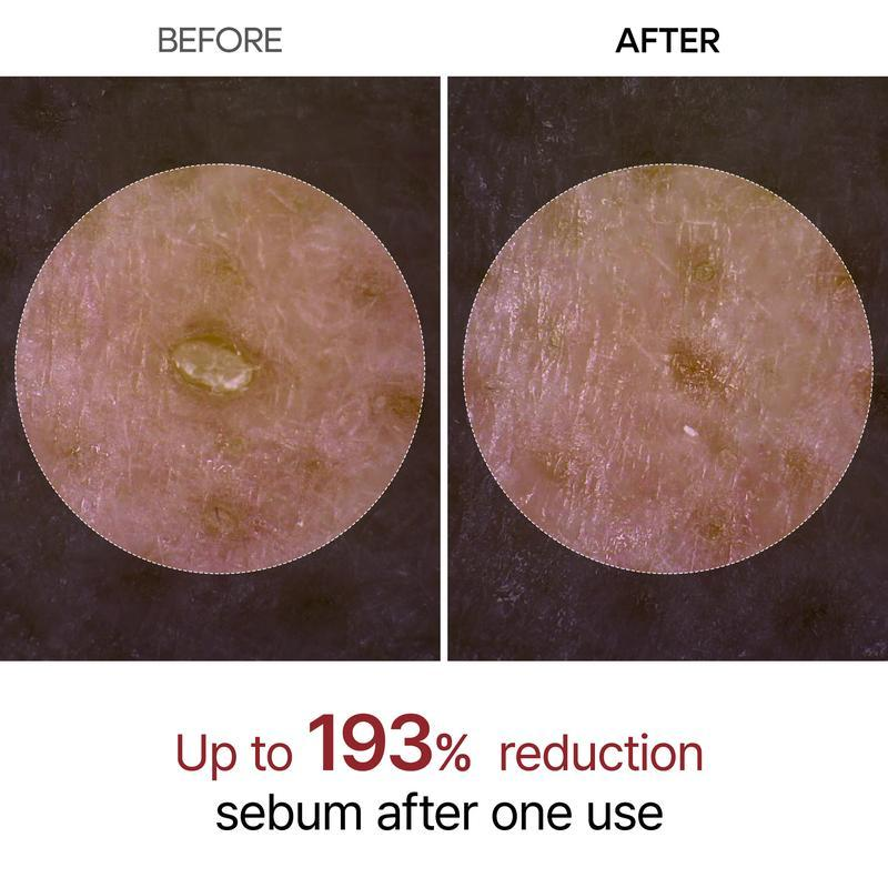✨Last Day 50%OFF:Miniyou™ Glow White Rice Peeling Ampoule✨