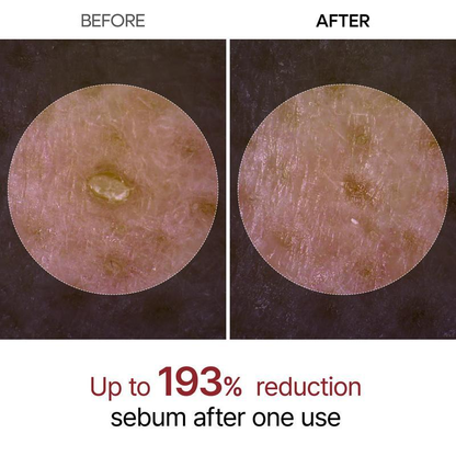 ✨Last Day 50%OFF:Miniyou™ Glow White Rice Peeling Ampoule✨